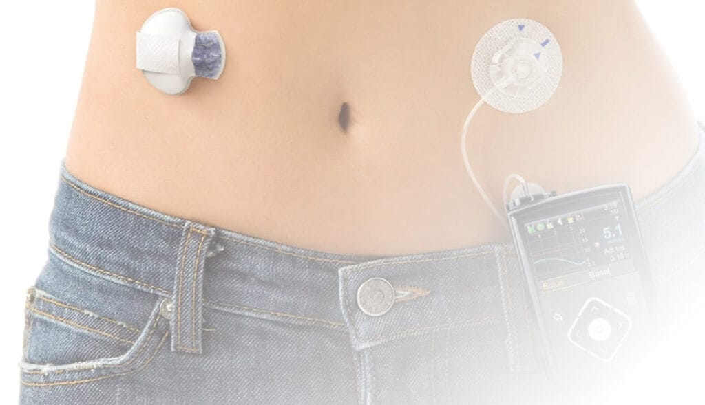 insulin pump battery solutions