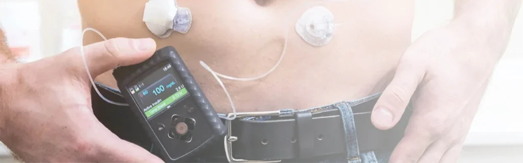 Insulin Pump 29 insulin pump battery