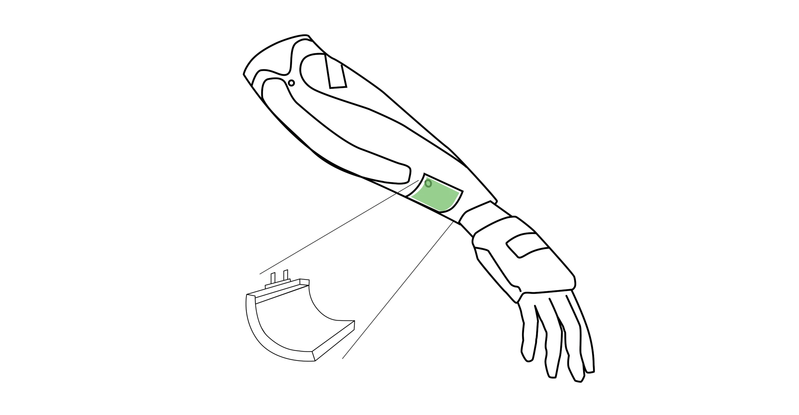 Smart Prosthesis 1 smart prosthesis battery