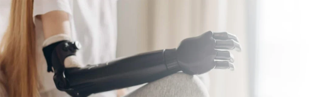 Smart Prosthesis 28 smart prosthesis battery